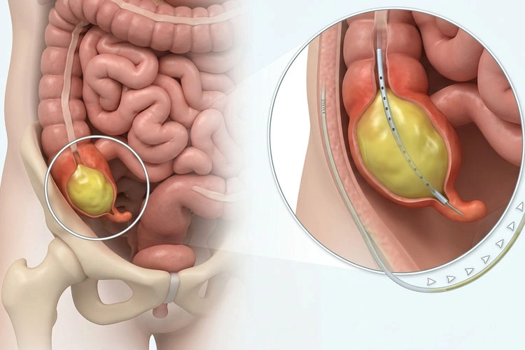 Dr. Diego García Caballero Especialista en Cirugía Laparoscópica y Cirugía Gastrointestinal