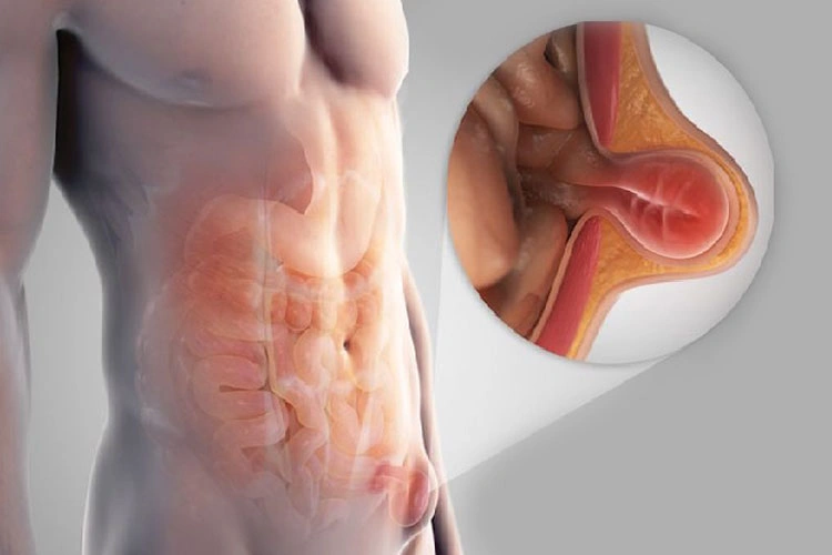Dr. Diego García Caballero Especialista en Cirugía Laparoscópica y Cirugía Gastrointestinal